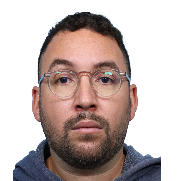 Fue Before and After | Dr. Jeffrey Wise