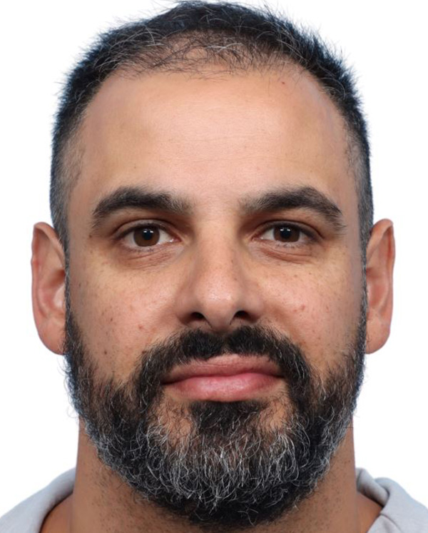 Fue Before and After | Dr. Jeffrey Wise