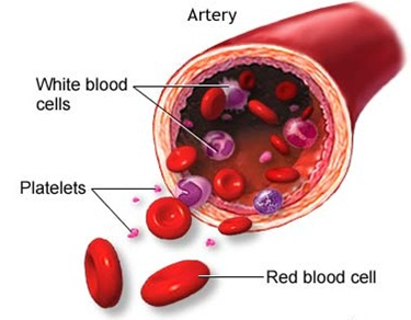 Platelet Rich Plasma in New Jersey